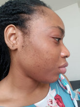 Load image into Gallery viewer, Kojic Discoloration Bar Soap