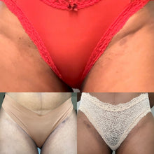 Load image into Gallery viewer, Tough Skin Renewal Package