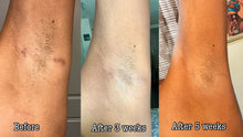 Load image into Gallery viewer, Rejuvenating Hyperpigmentation Body &amp; Face Glow Soap
