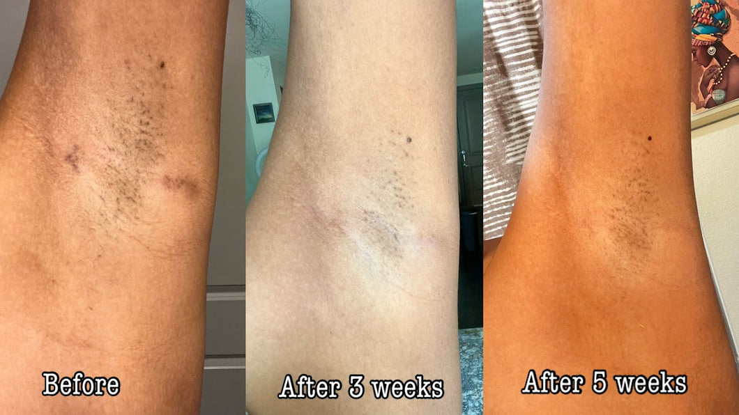 Rejuvenating Hyperpigmentation Body & Face Glow Soap